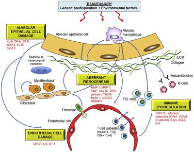 Novel diagnostic techniques in interstitial lung disease